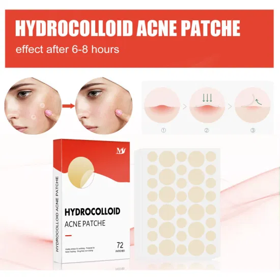 OEM acné soins de la peau 72 patchs imperméable hydrocolloïde acné bouton absorbant couverture et tache d'imperfection